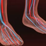 10 Warning Signs of Poor Blood Circulation in the Legs